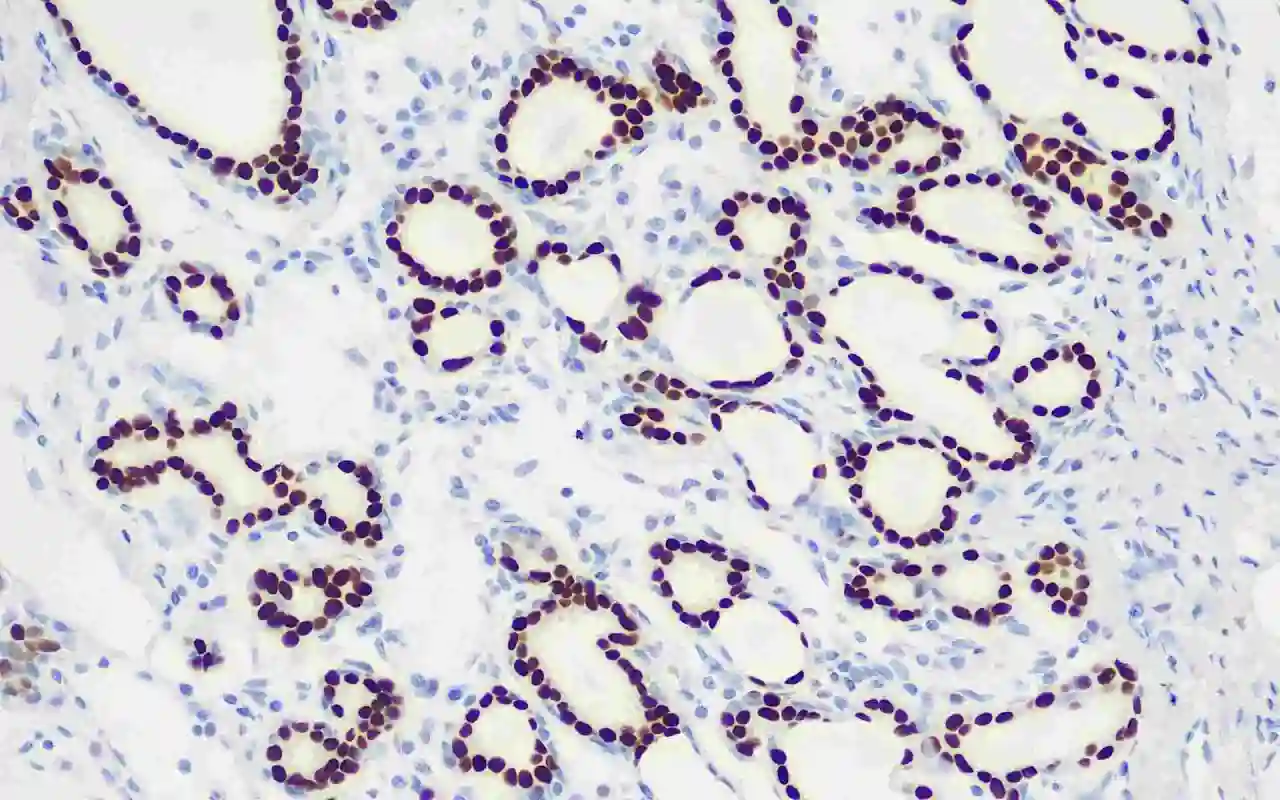 Estrogen Receptor α