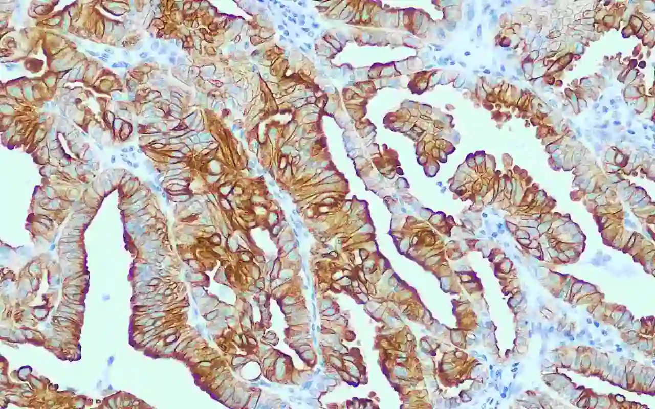 Cytokeratin 19
