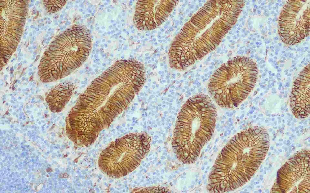 Beta-catenin