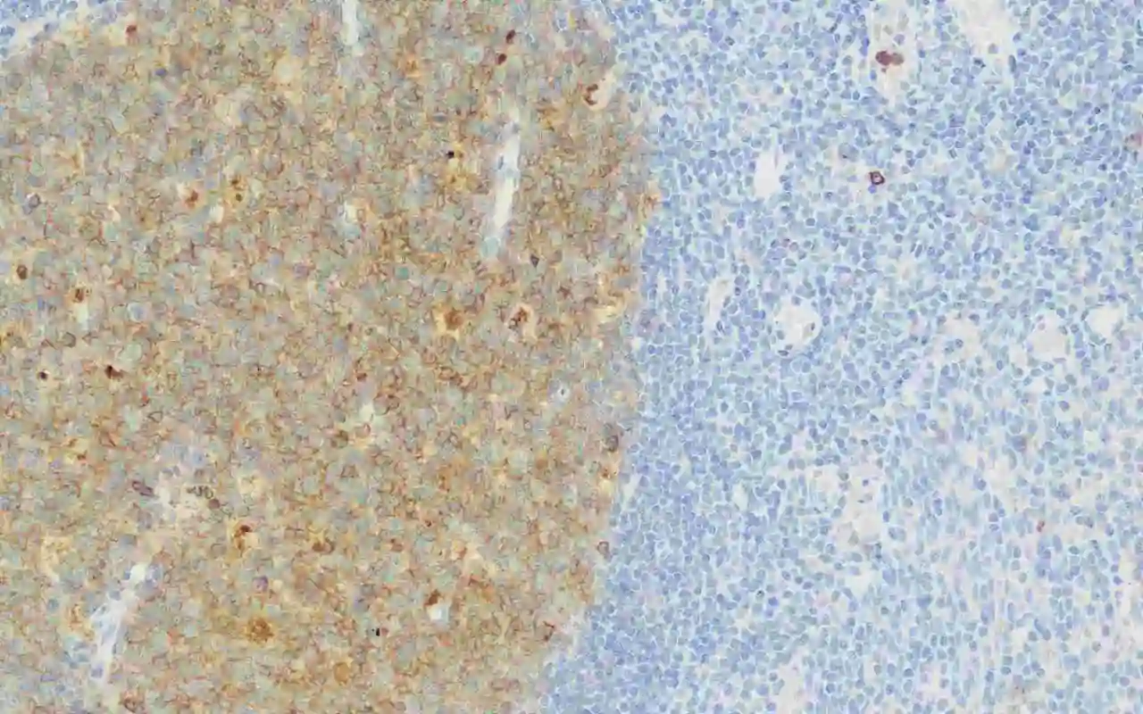 CD10