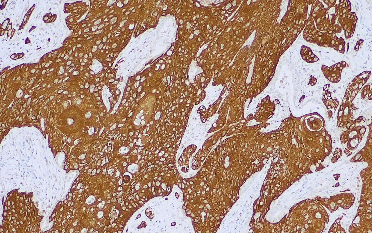 Cytokeratin 5/6