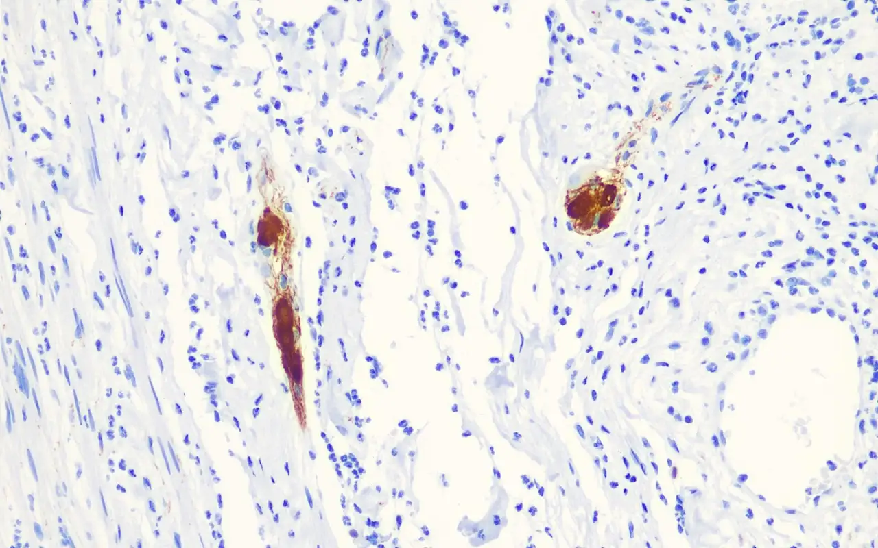 Calretinin