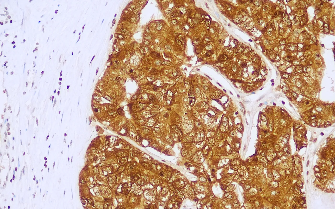 Glypican-3