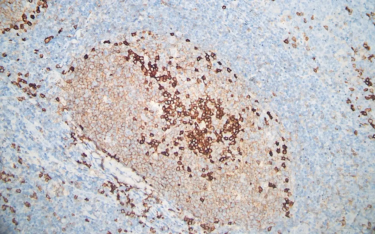 CD38