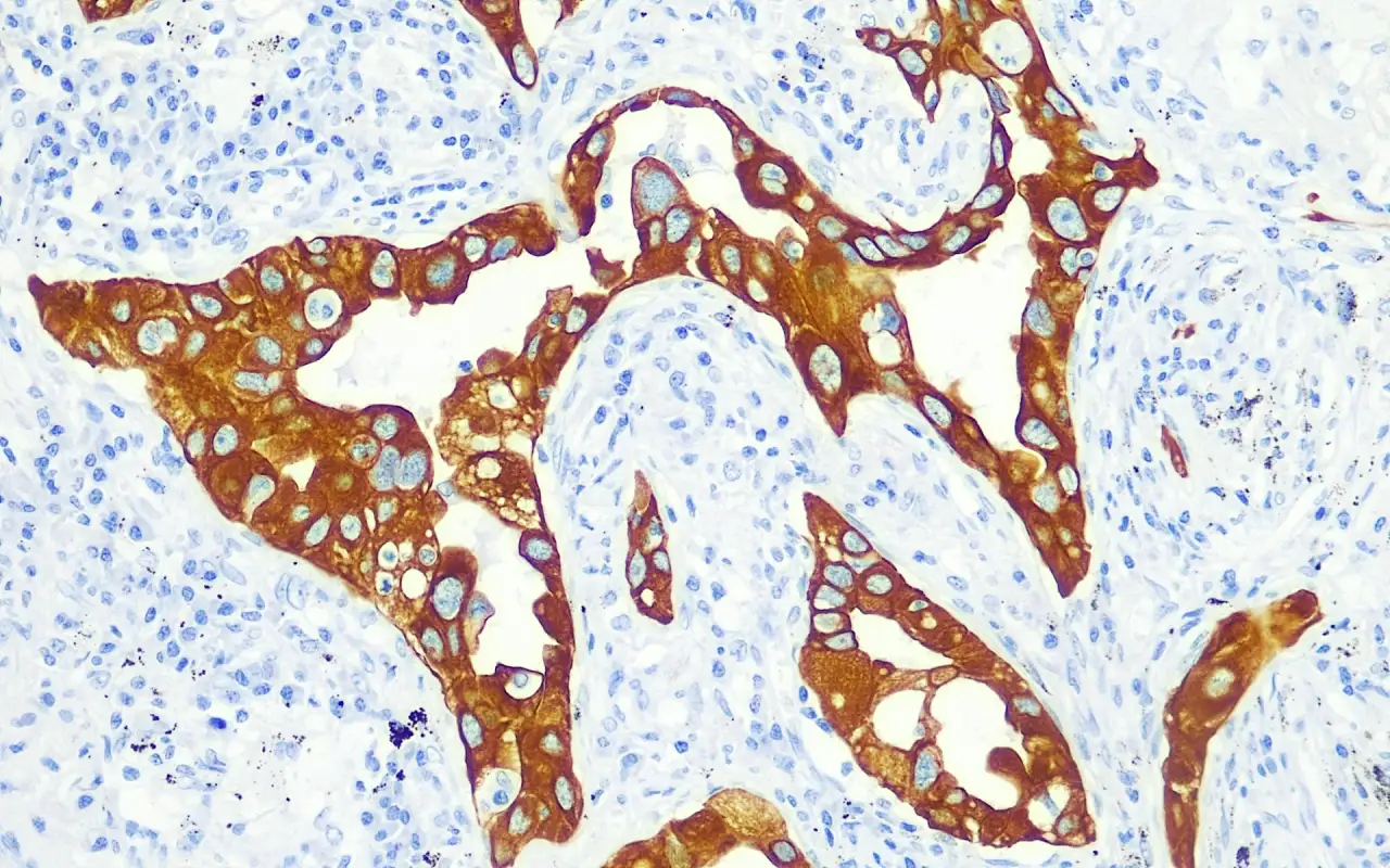 Cytokeratin 7