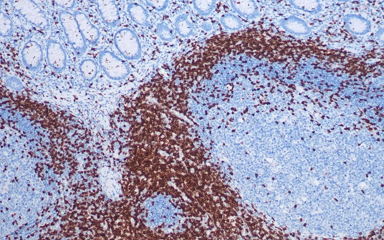CD3
