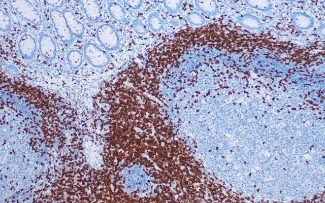 CD3