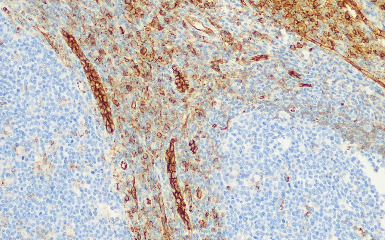 CD31
