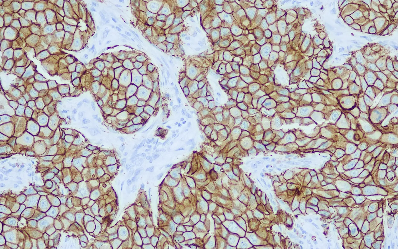 E-cadherin