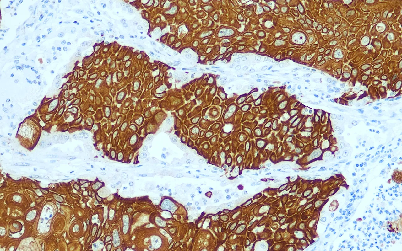 Cytokeratin 5/6