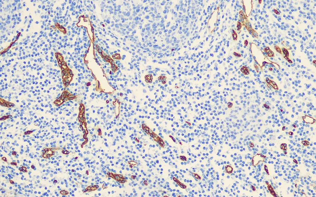 CD34