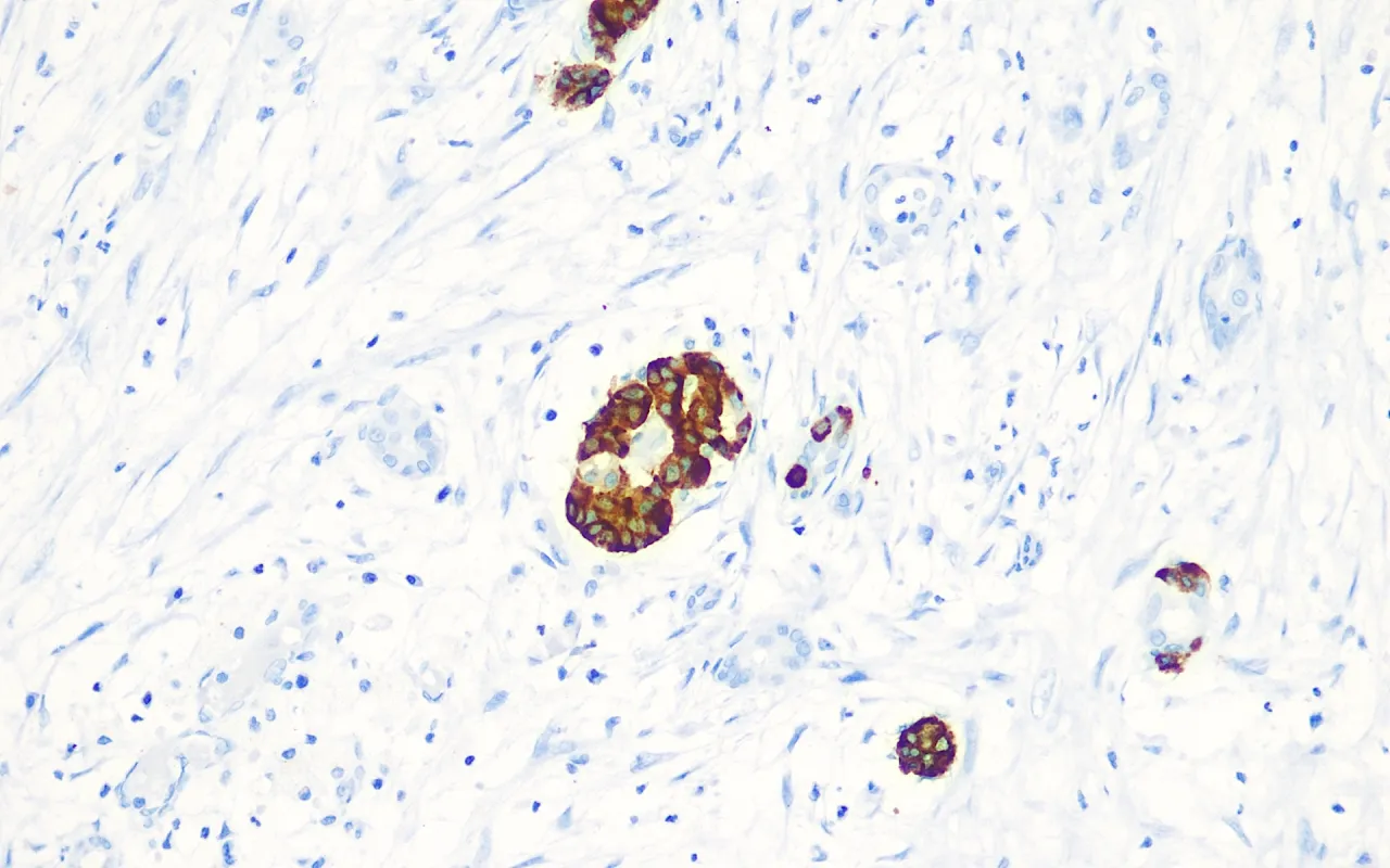 Chromogranin A