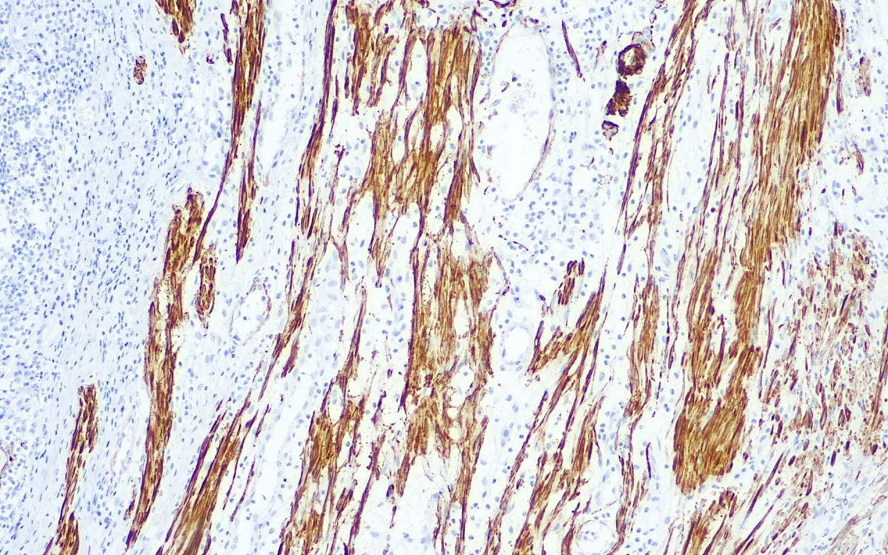 Smooth Muscle Myosin