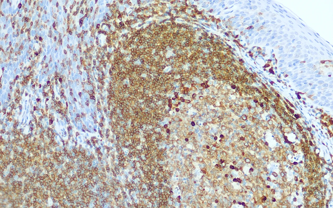 CD79a