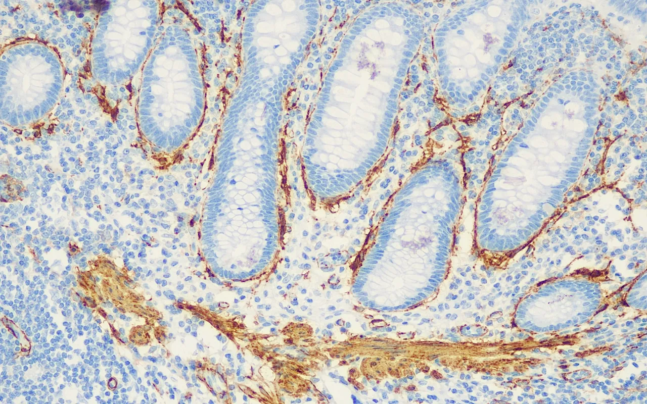 Actin, Smooth Muscle