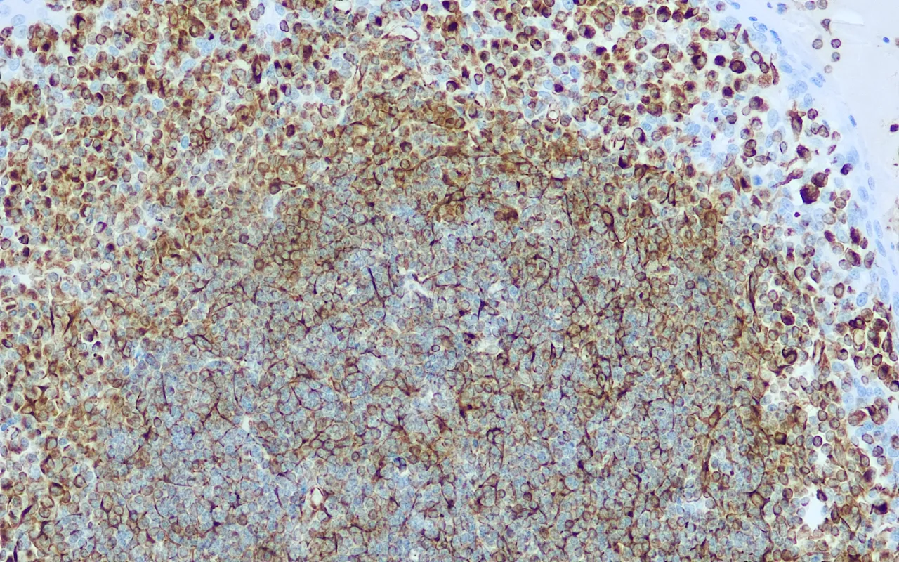 Vimentin