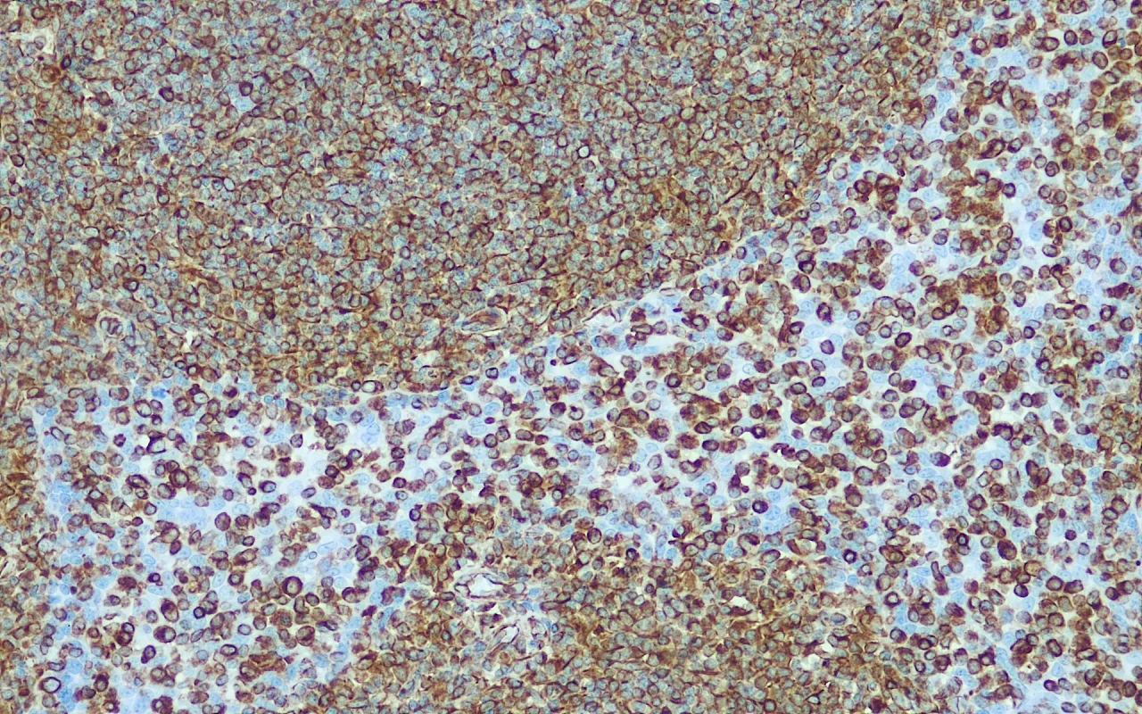 Vimentin