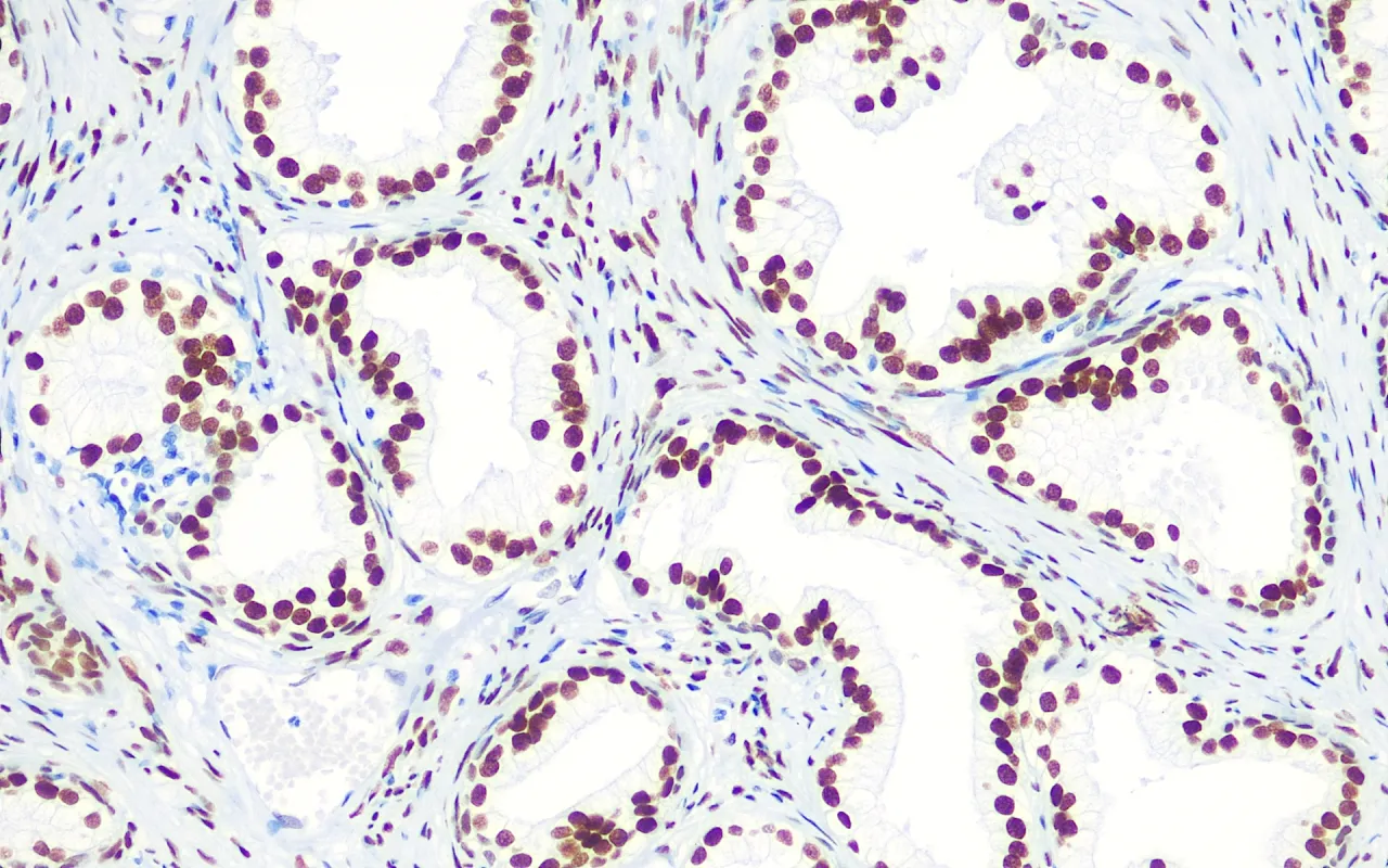 Androgen Receptor