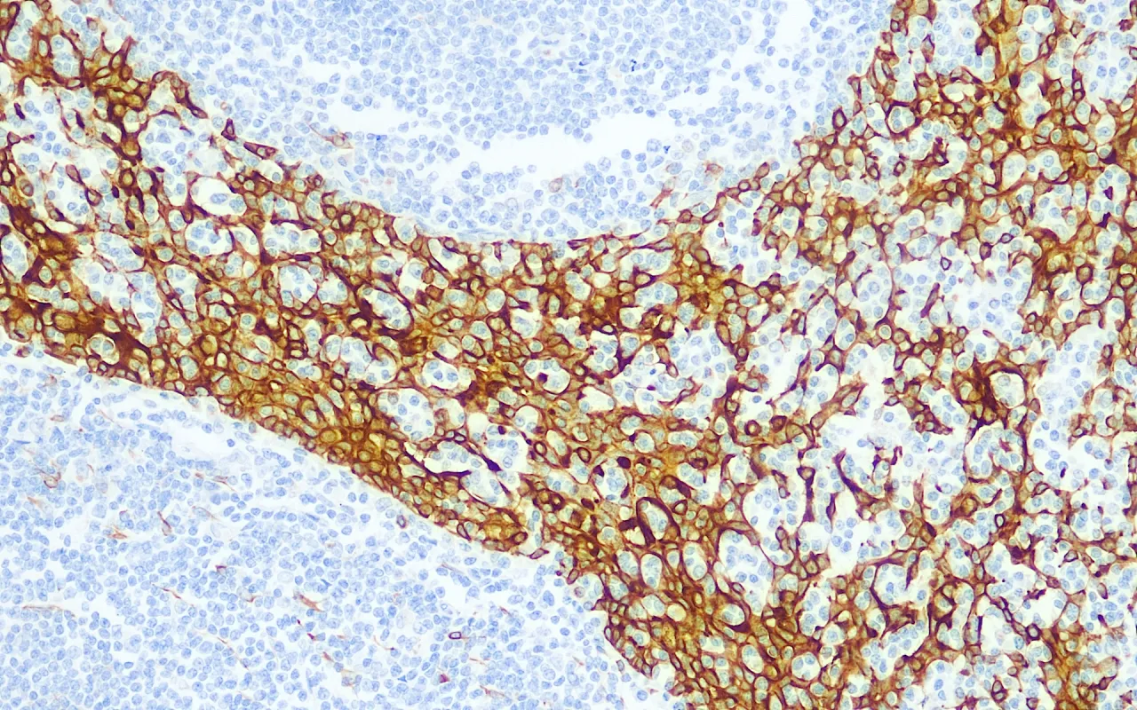 Cytokeratin 8