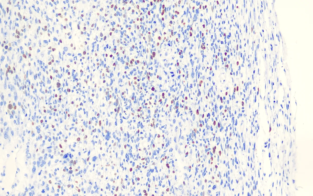 Myogenin