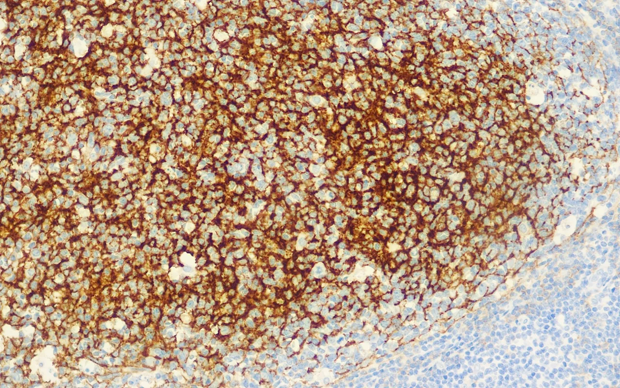 CD35