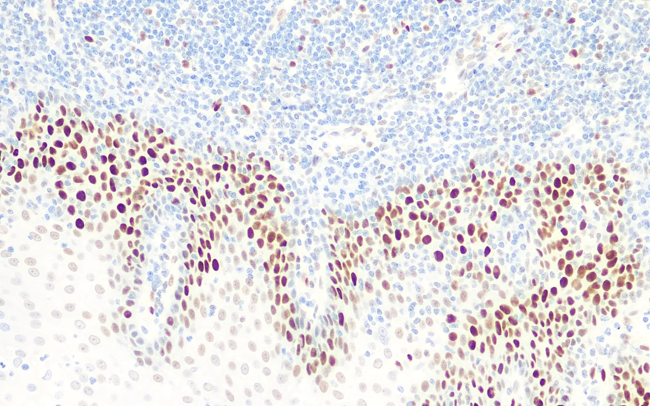 Rb Gene Protein