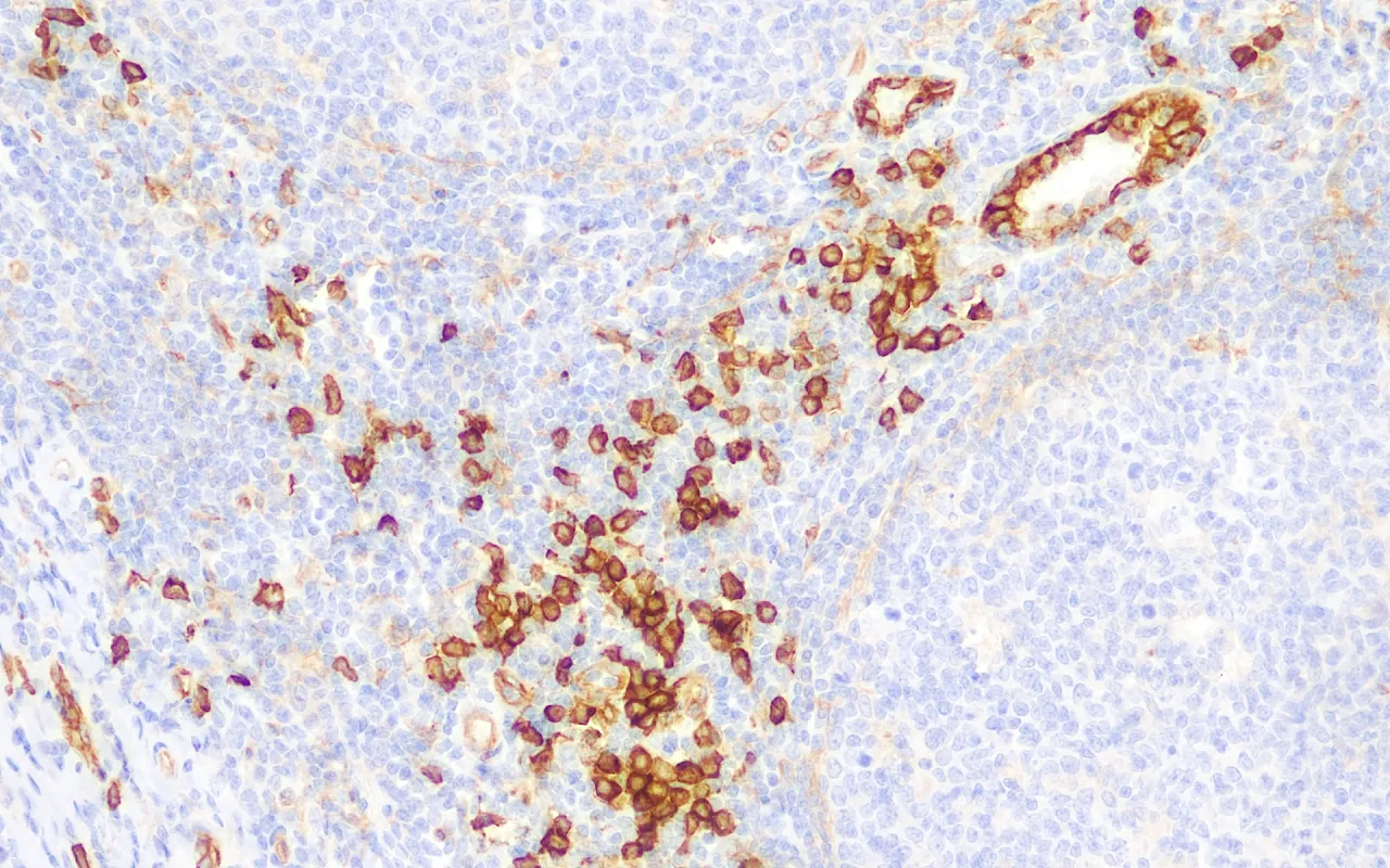CD123