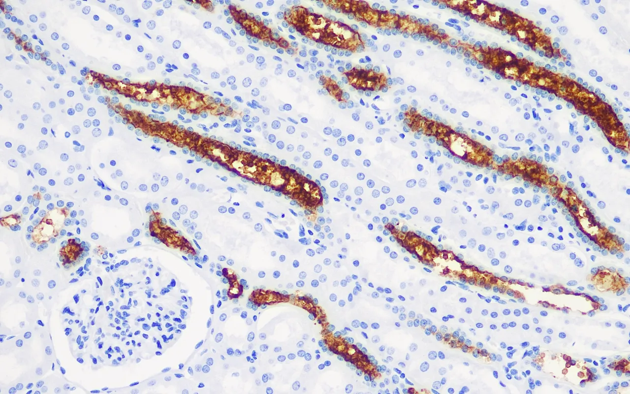 BCA-225
