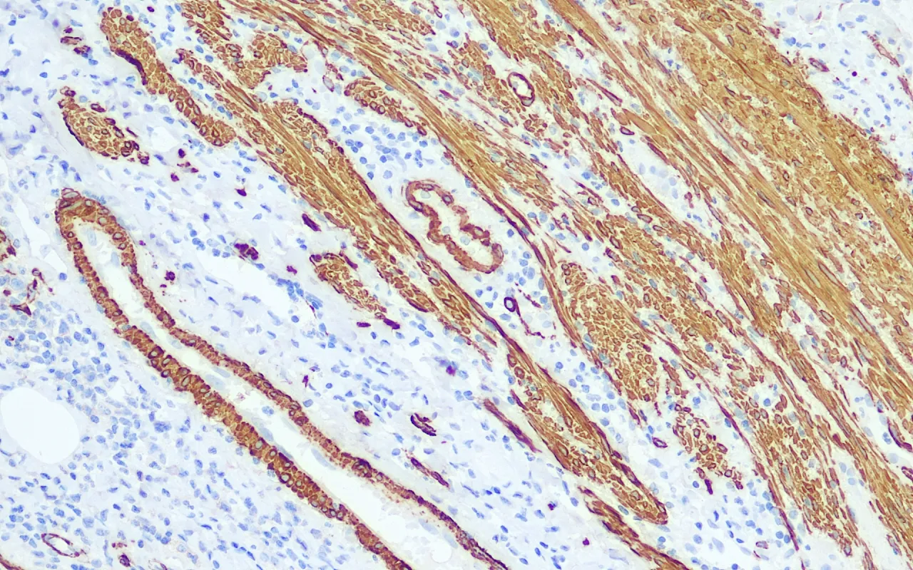 Actin,Muscle Specific