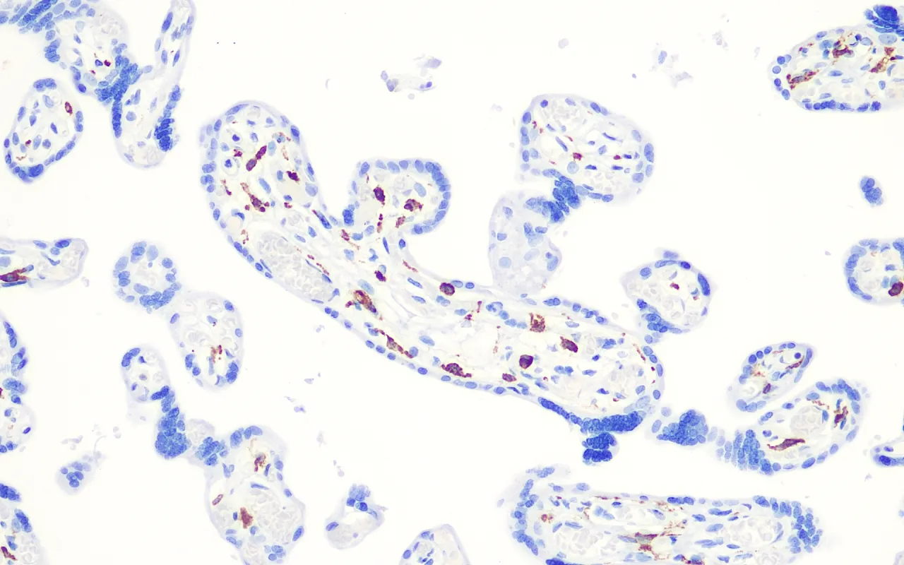 CD163