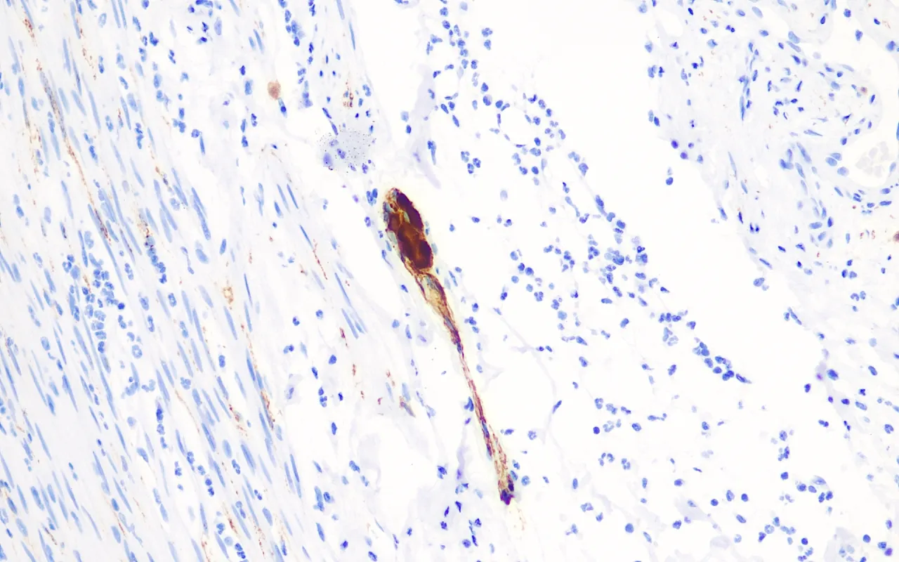 Calretinin