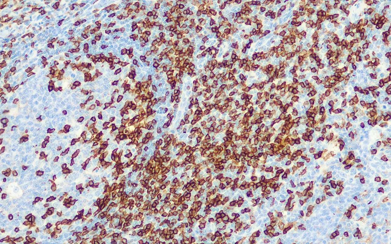 CD45RO