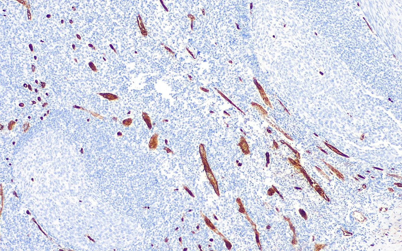 CD34