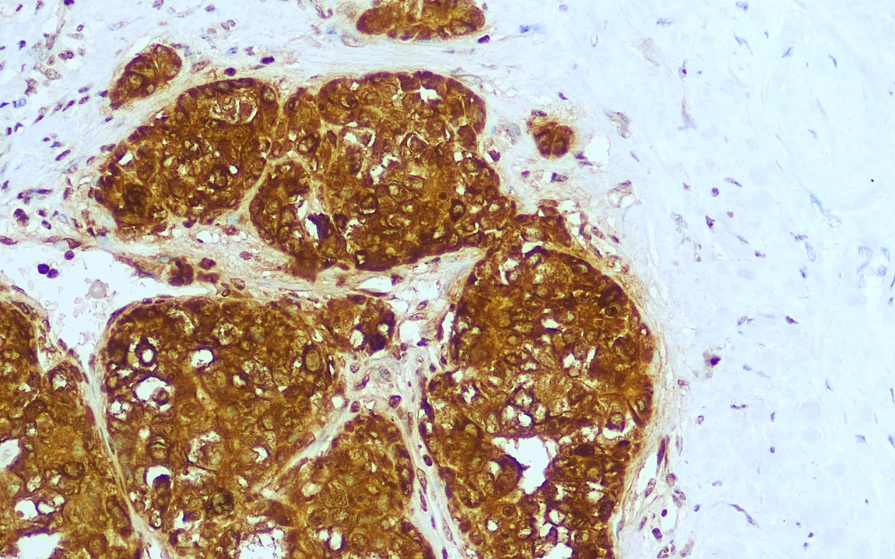 Glypican-3
