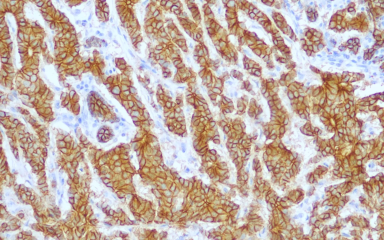 E-cadherin