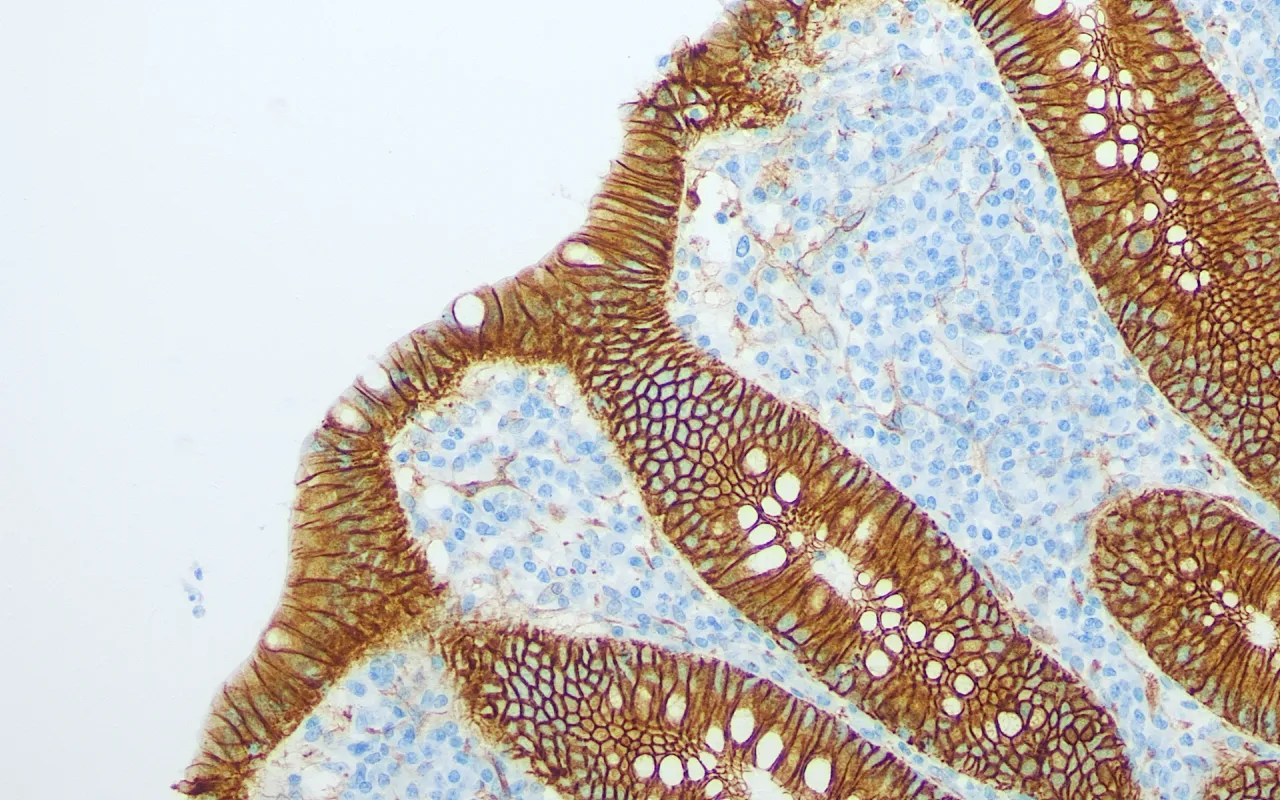 Beta-catenin
