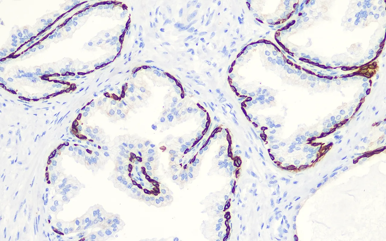 Cytokeratin 34βE12