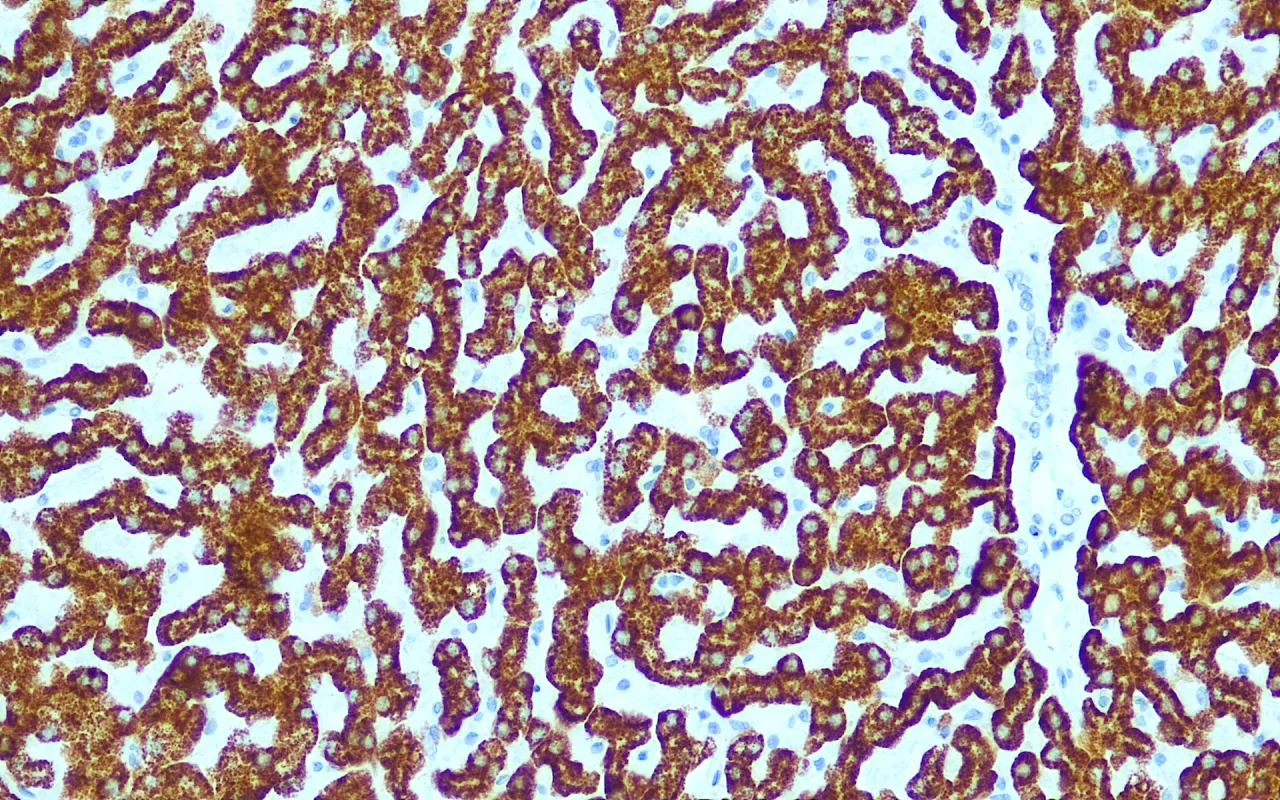 Hepatocyte Specific Antigen