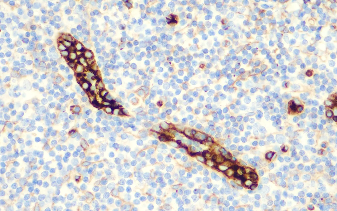 CD105