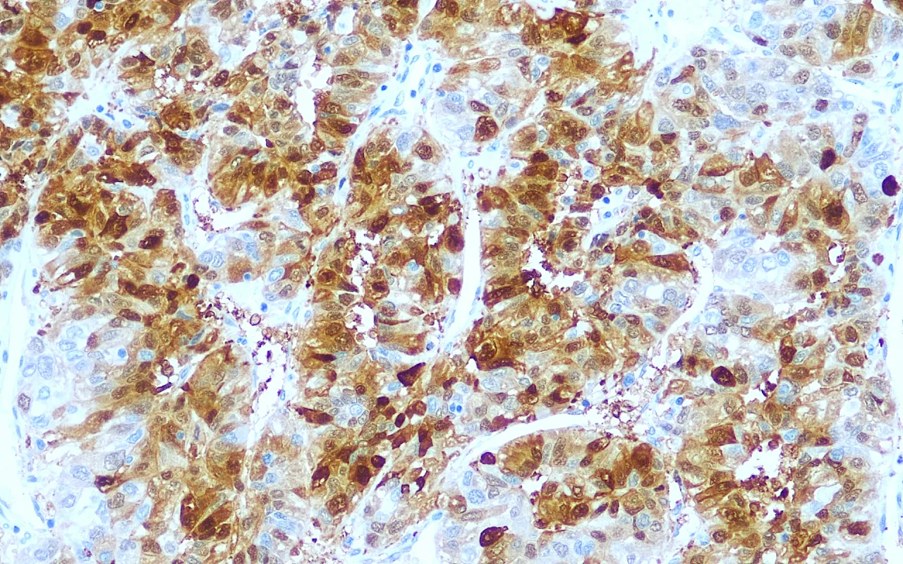 HSP70