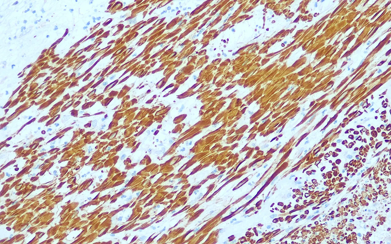 Caldesmon