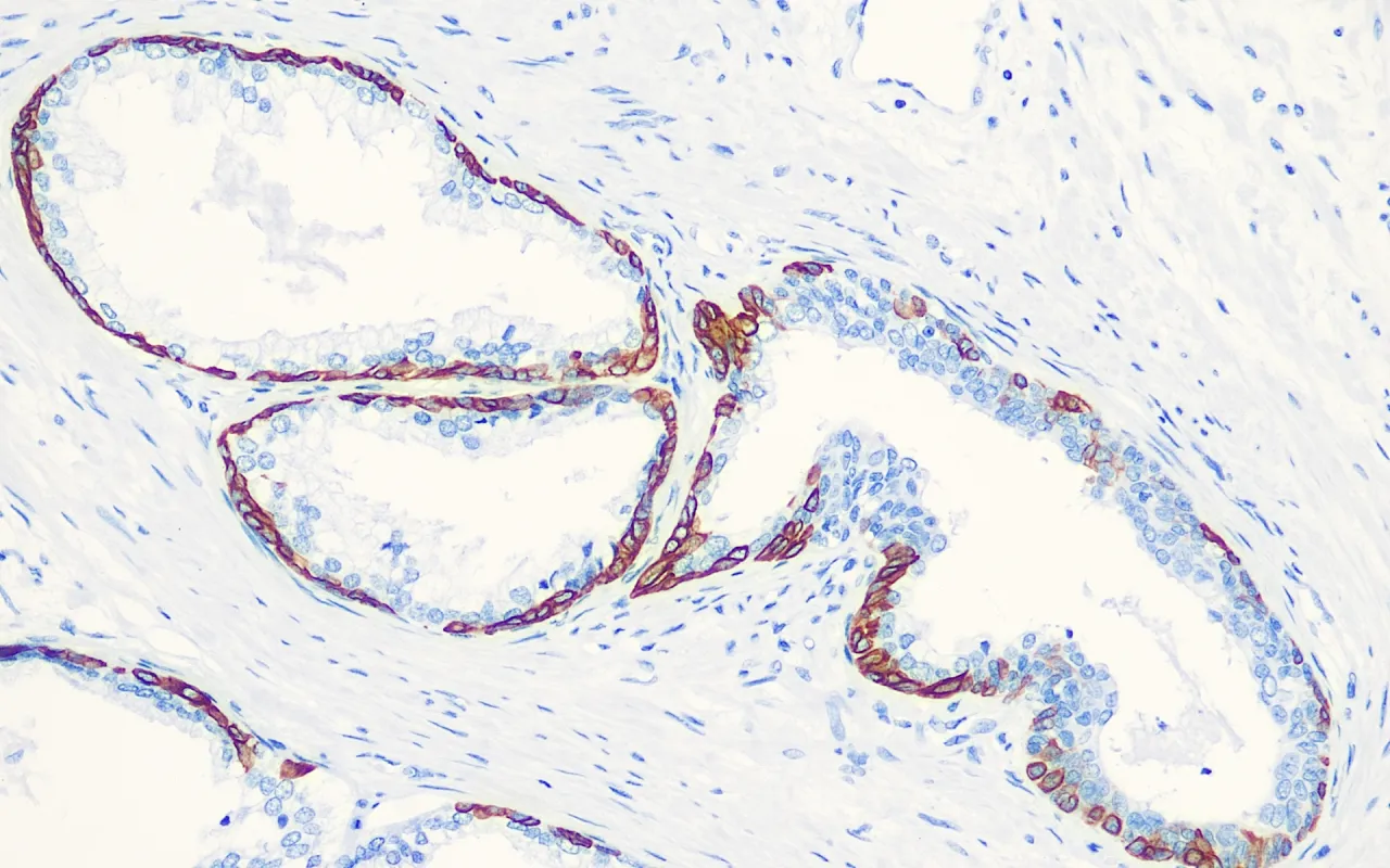Cytokeratin 14