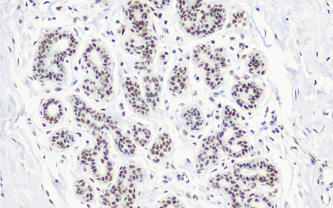 BRCA-1