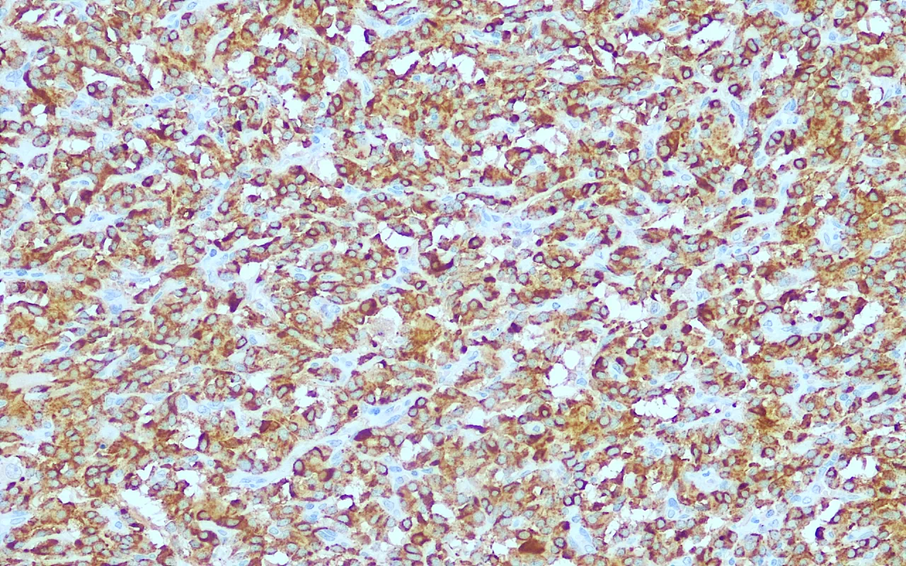 Calcitonin
