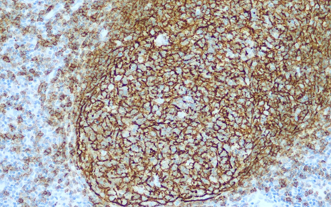 CD21