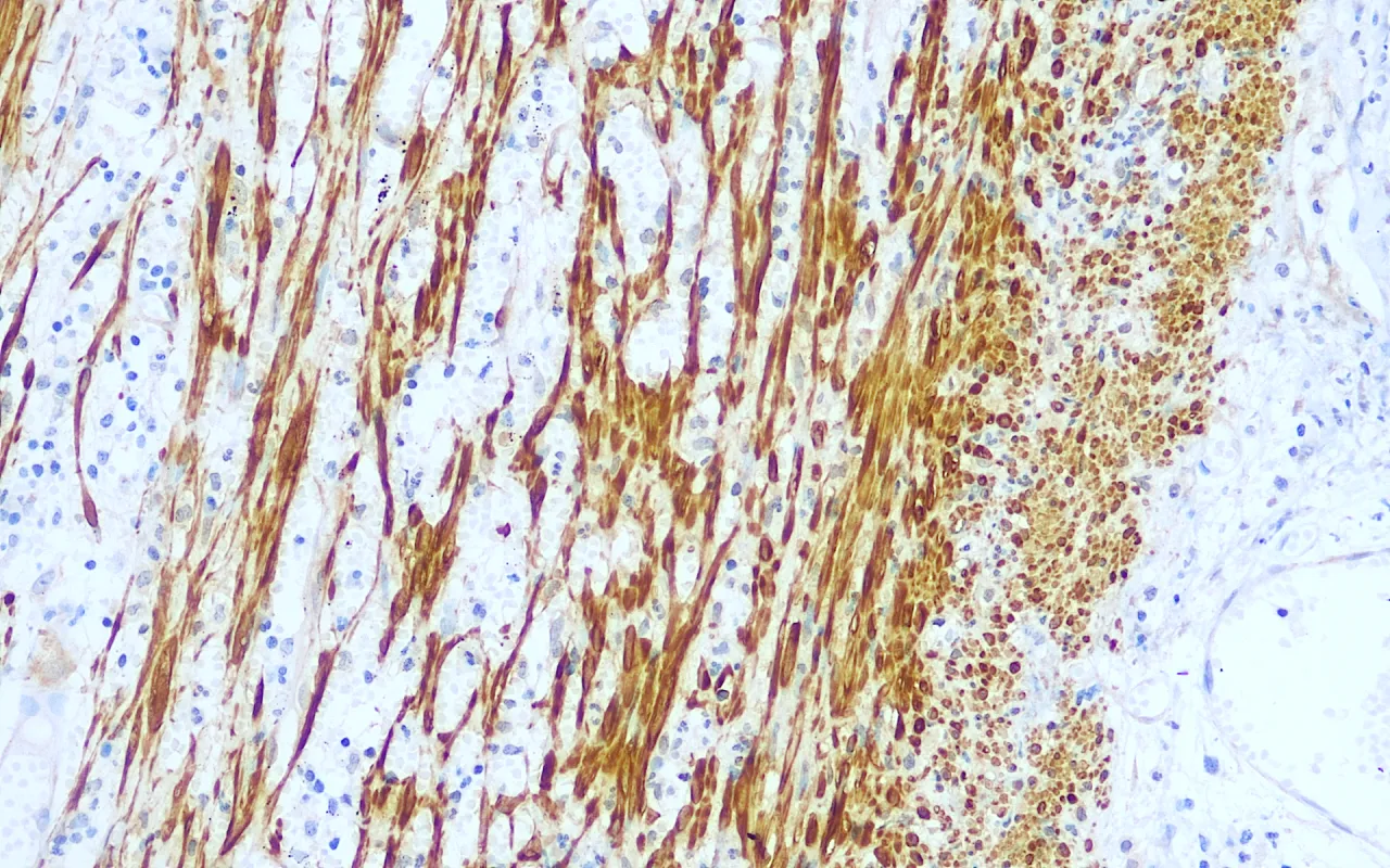 Calponin-1