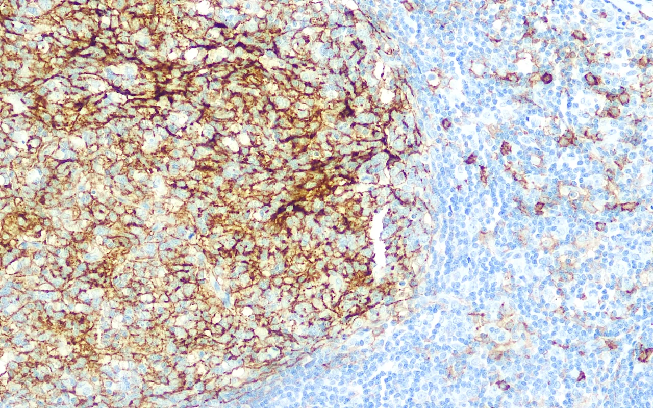 CD14
