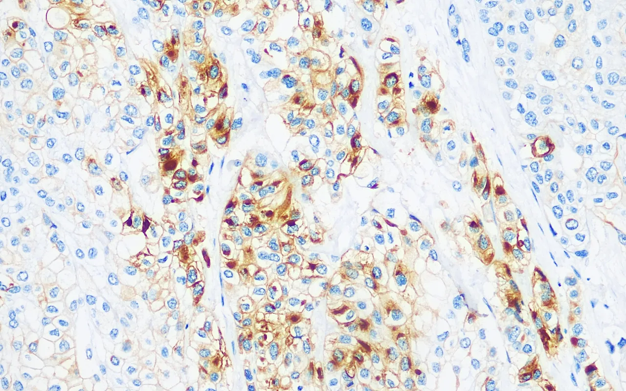 Uroplakin III