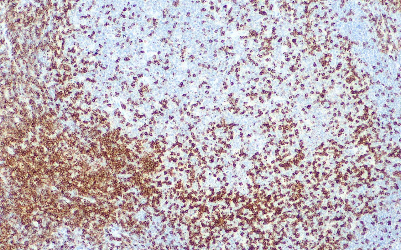 CD2