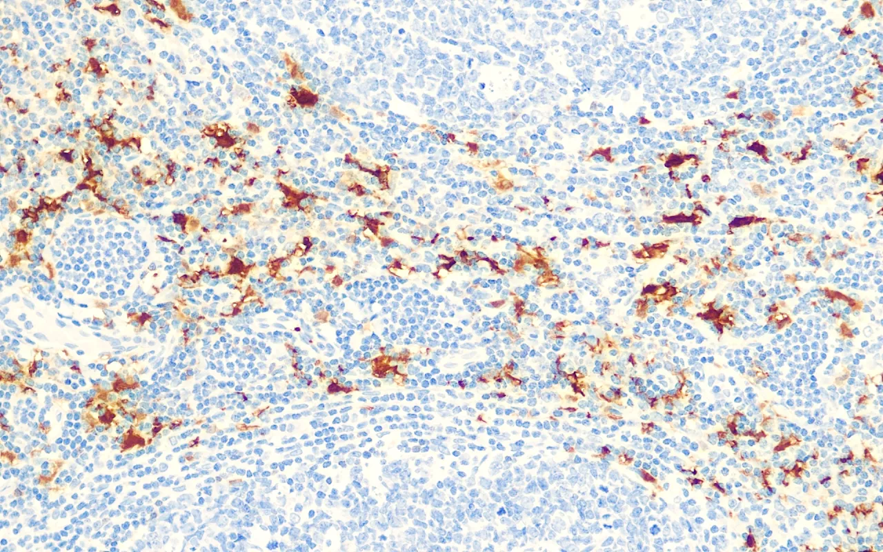 Factor XIIIa